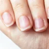 Solución para uñas quebradizas
