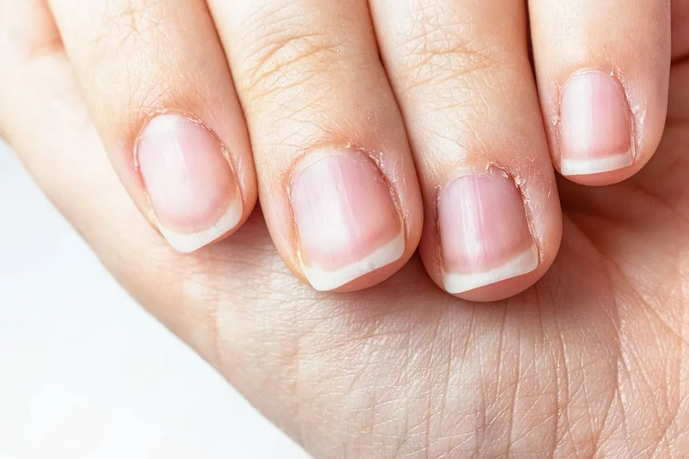 Solución para uñas quebradizas